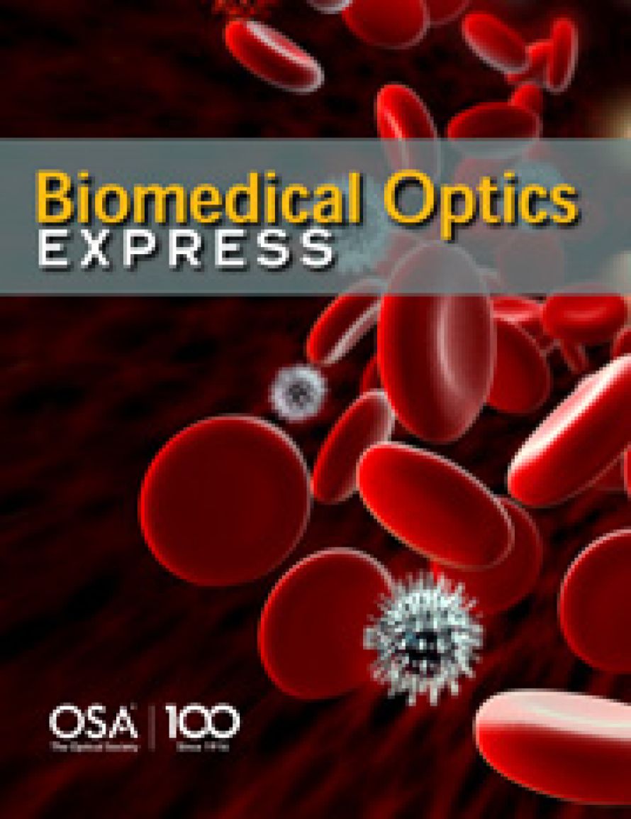 Cover page of the Biomedical Optics Express publication "All-optical highly sensitive akinetic sensor for ultrasound detection and photoacoustic imaging", illustrating XARION's optical microphone / laser-excited ultrasound technology